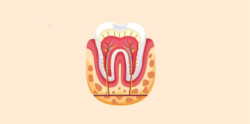 Root Canal Treatment